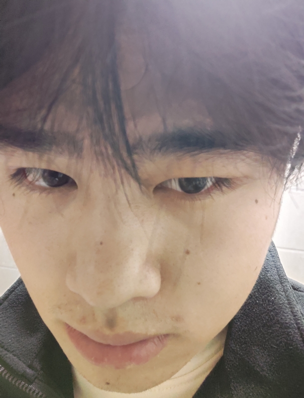 伤男的第一张照片--河南王婆说媒